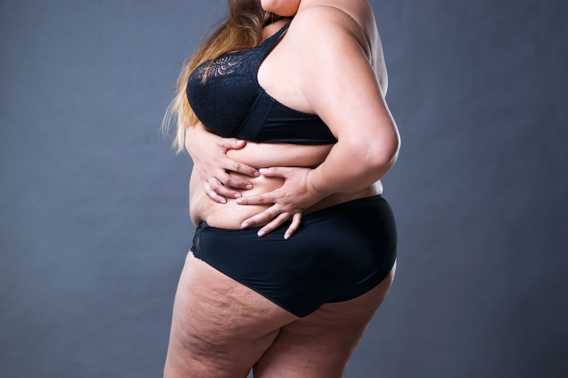 Lipedema Treatment in Beverly Hills, CA and Tucson, AZ