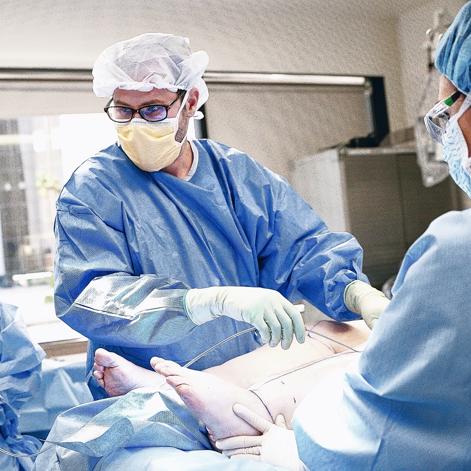 Lipedema Treatment in Beverly Hills, CA