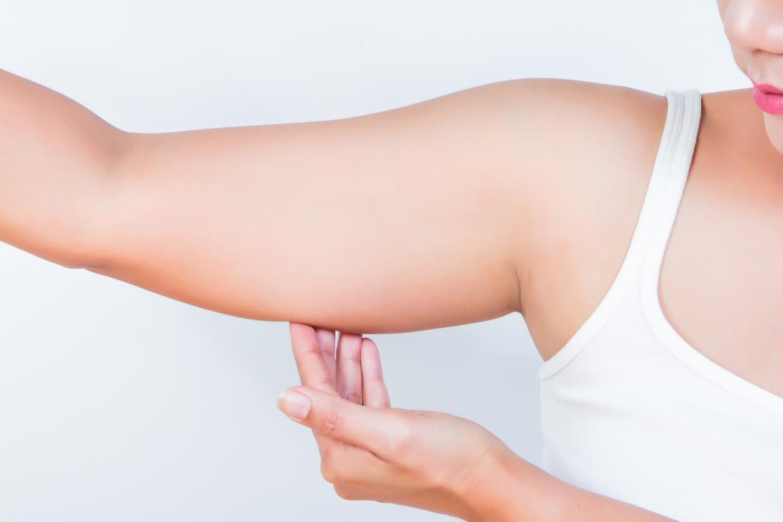 Lymphatic Sparing Arm Lift in Beverly Hills, CA
