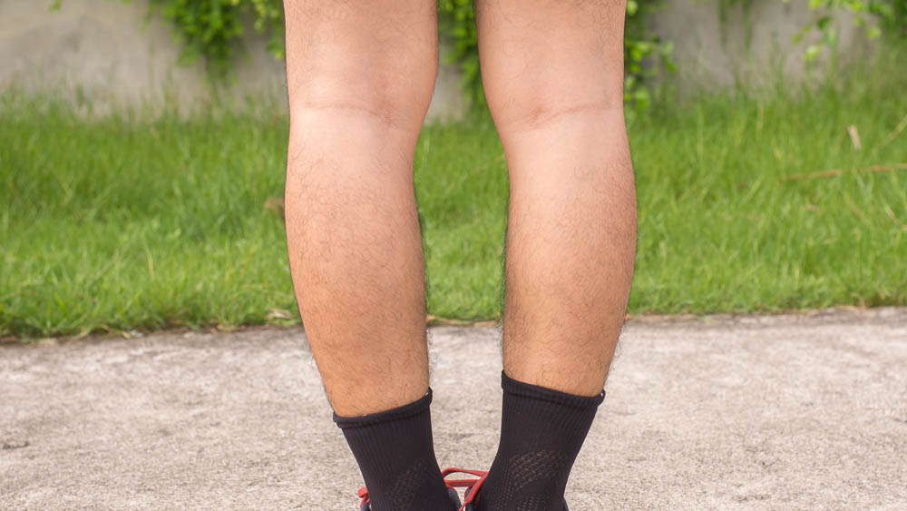 Knock Knees Treatment:  Do I Have Lipedema?