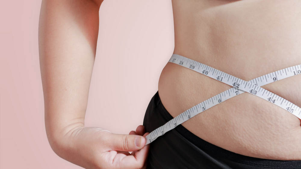 Lipedema and Obesity Treatment in Beverly Hills, CA and Tucson, AZ