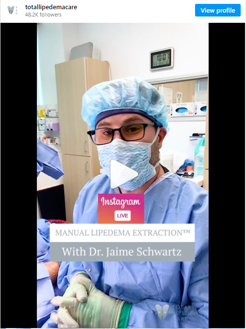 MANUAL LIPEDEMA EXTRACTION™ IN BEVERLY HILLS, CA & TUCSON, AZ