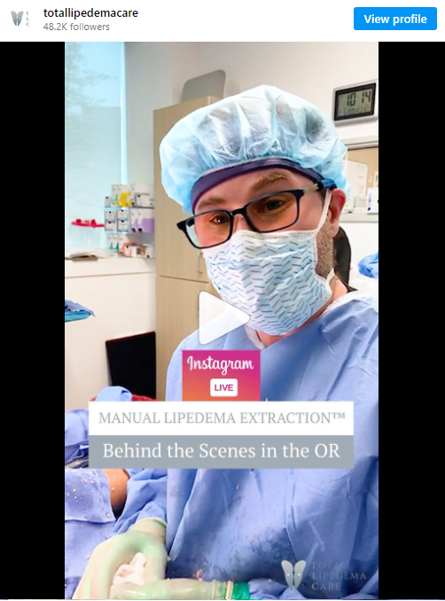 MANUAL LIPEDEMA EXTRACTION™ IN BEVERLY HILLS, CA & TUCSON, AZ