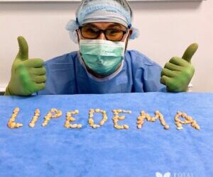 What Does Lipedema Reduction Surgery Look Like?